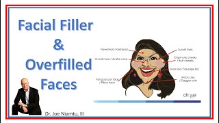 Facial Filler and Overtreated Faces [upl. by Issor]