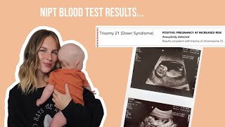 Positive NIPT for trisomy 21down syndrome  NIPT results story time [upl. by Bore]