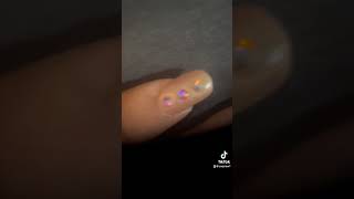 Acrylic nails done by me for me selfcare selflove shortvideo getwellsoon [upl. by Raama]