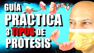 TIPOS de PRÓTESIS REMOVIBLES comparativa [upl. by Lemaceon279]