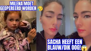 MILENA MOET HIERAAN GEOPEREERD WORDEN😢 amp SACHA HEEFT HIERDOOR EEN DIK OOG 😱😳  VLOG 228 [upl. by Naivat]