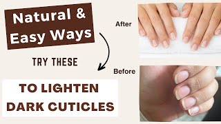 6 Tips to Lighten amp Treat Dark Cuticles [upl. by Huesman667]