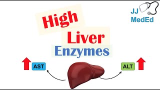 High Liver Enzymes  Aspartate vs Alanine Aminotransferase AST vs ALT  Causes [upl. by Grey]