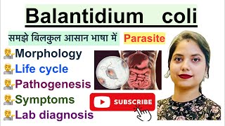 Balantidium coli in Hindi  Parasite  Morphology  Life Cycle  Symptoms  Hindi  Parasitology [upl. by Nolyat81]