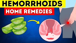 Say Goodbye to Hemorrhoids 8 Home Remedies That Actually Work [upl. by Wertheimer759]