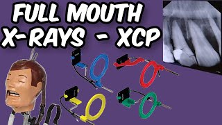 Full Mouth XRays  XCP Tips and Tricks [upl. by Cornwell983]