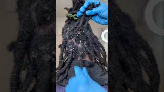 Seborrheic Dermatitis scalp haircare education scalpcare voiceover [upl. by Amyaj91]