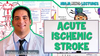 Acute Ischemic Stroke Etiology Pathophysiology Clinical Features Diagnostics Treatment [upl. by Omura]