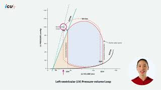 Contractility and Stroke Volume on Left Ventricular Pressure Volume Loop [upl. by Bianka]