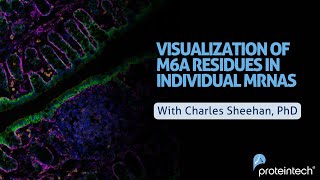 Visualization of m6A residues in individual mRNAs [upl. by Gratiana319]