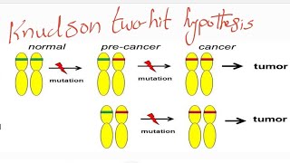 knudson two hit hypothesis compound heterozygote and consanguinty [upl. by Hale]