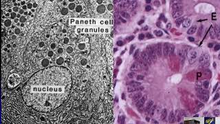 Ultrastructural Pathology Part 3  GI Hepatobiliary and Urinary [upl. by Anrahc]