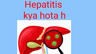 hepatitis bhepatitis chepatitishepatitis aviral hepatitishepatitis b treatment [upl. by Sumerlin]