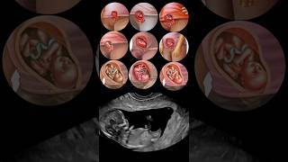 Fetal Development Month by Month😍 [upl. by Ogires453]