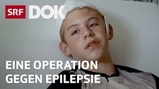 Epilepsie bei Kindern  Svens Entscheidung für eine Operation  Doku  SRF Dok [upl. by Assila528]