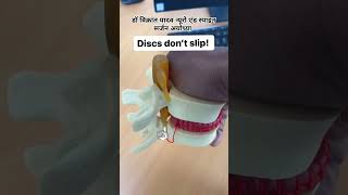 🥰❤️disc bulge causes🥰❤️music hiphop automobile funny facts musicstreaming trendingmotivation [upl. by Eek22]