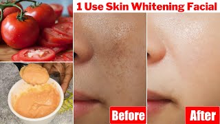 1 Time👆Skin Whitening Tomato Facial1 बार में निखर जाएगी रंगत दाग धब्बे होंगे साफ़ चमक उठेगा चेहरा [upl. by Mairam]