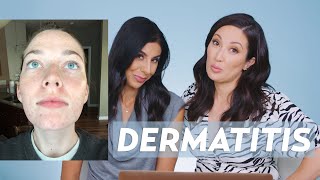 Perioral Dermatitis and Acne Skincare Routine for Jessie [upl. by Tremml468]