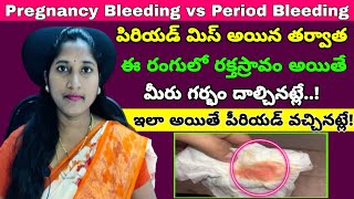 ఇలా రక్తస్రావం కనిపిస్తే గర్భం దాల్చినట్లే  Implantation Bleeding vs Period Bleeding  Spotting [upl. by Thomey]