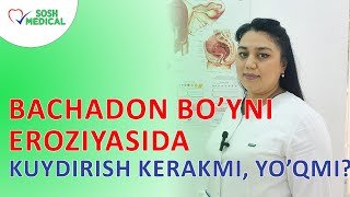 Bachadon boʻyni eroziyasida kuydirish kerakmi yoʻqmi [upl. by Akiam]