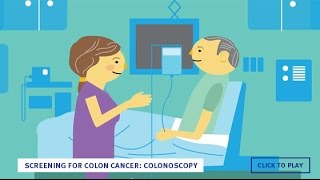 Screening for Colon Cancer Colonoscopy English [upl. by Jahdiel813]