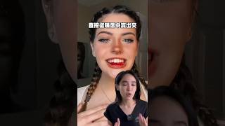 她牙齦流好多血😱牙周病血友病白血病 [upl. by Fronnia119]