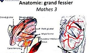 Traitement chirurgical des escarres pelviennes chez le patient neurologique [upl. by Anyer]