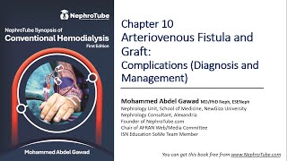 Hemodialysis Chapter 10 Arteriovenous Fistula amp Graft Complications  DrGawad Arabic Language [upl. by Eidoc963]