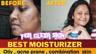 Acne to clear skin ✨️  How to get rid of acne and dark spots skincare products acneacneproneskin [upl. by Jeritah]