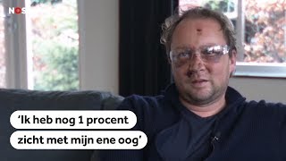 JAARWISSELING Vuurwerkslachtoffer Paul kreeg de volle laag [upl. by Cartan113]