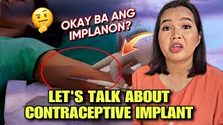 IMPLANONOKAY NGA BA ANG CONTRACEPTIVE IMPLANTFAMILY PLANNINGBIRTH CONTROL [upl. by Hcire]