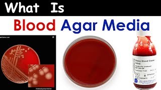 What is Blood Agar Media   Complete amp Clear Overview [upl. by Varden248]