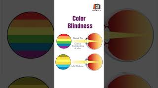 EyeOpening Facts About Color Blindness in Hindi Short Video [upl. by Jea]