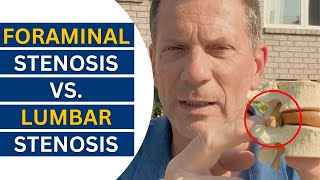 Foraminal vs Lumbar Stenosis Breakthrough Treatment Revealed  Dr John Zielonka [upl. by Samal]