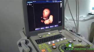 Sonoscape S8 4D operation training video [upl. by Neehsar]