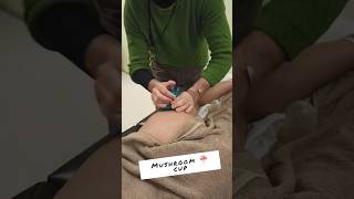 Ultimate 🥏 AntiCellulite Cupping Massage massagetreatment massagetherapy bodywork [upl. by Bartholomeo]