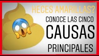 ✅Heces amarillas y las principales causas VÍDEO MUY IMPORTANTE [upl. by Inhoj]