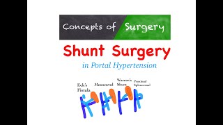 Shunt Surgeries in Portal Hypertension [upl. by Narbig575]