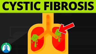 Cystic Fibrosis Medical Definition  Quick Explainer Video [upl. by Corabel362]