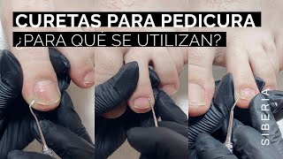 Curetas para Pedicura profesional🦶 para qué se utilizan y técnica de uso [upl. by Eremihc377]