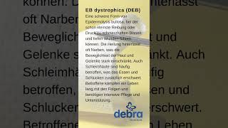 EB dystrophica DEB Eine schwere Form von Epidermolysis bullosa [upl. by Bale]