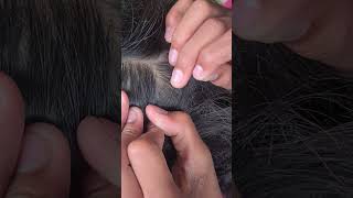 Lice picking hair headlice haircare headliceremoval louse headlicetreatment short1 [upl. by Reppep]