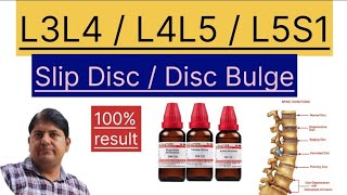 Homeopathic medicine  L3L4  L4L5  L5S1 Disc Bulge  Slip disc  Herniated disc ka jad se ilaj [upl. by Ziguard]