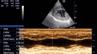 ECOCARDIOGRAFIA DOPPLER ESTENOSIS SUBAORTICA EN CANINOS IVAN ALVAREZ [upl. by Jenesia519]