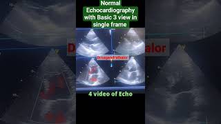 Normal Echocardiography of heart l PLAX PSAX A4C View l EF 60 l shorts [upl. by Nethsa145]