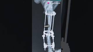 Biomaterials part 1 materialsscience biomaterials materialsengineering [upl. by Rothmuller]