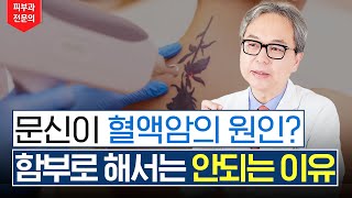 만약 문신하고 싶다면 이것 보고 판단하세요 문신 타투 혈액암 [upl. by Acirem]