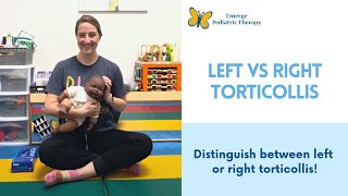 Left or Right Torticollis [upl. by Cand484]