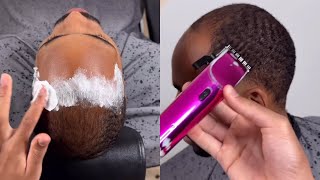 How To Fix A Balding Haircut [upl. by Helmer76]