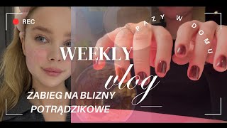 JAK ROBIĘ PAZNOKCIE W DOMU  JESIENIARA VLOG 🍂🍁 zabieg na blizny potrądzikowe  Zara Haul mierzymy [upl. by Prady]